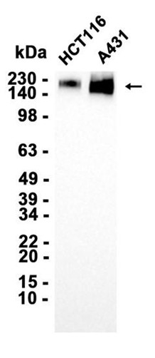 AYD14263