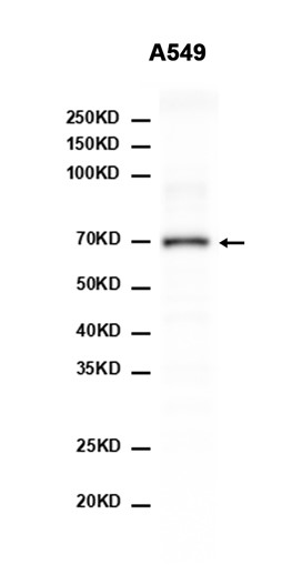 AYD11470