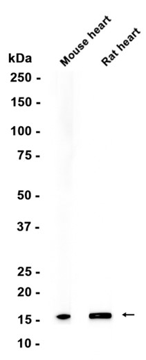 AYD11070