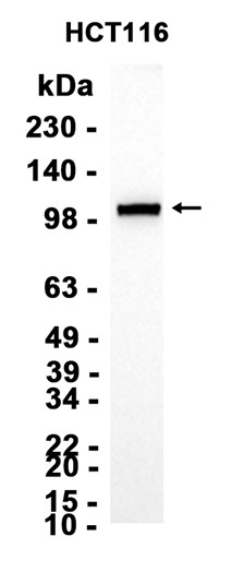 AYD11451