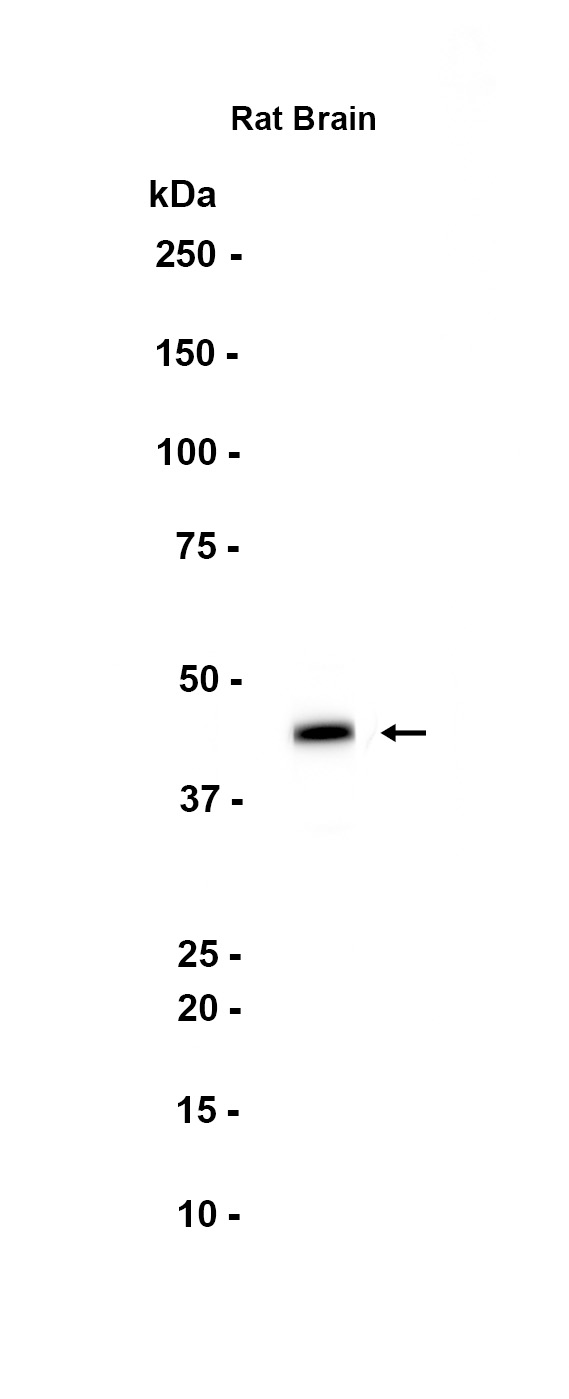 AYD15181