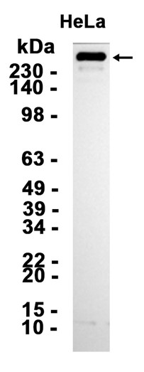AYD14301
