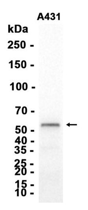 AYD12353