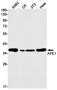 AYD11254
