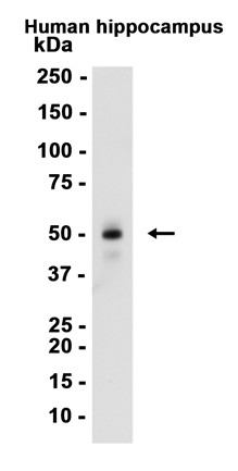 AYD12694