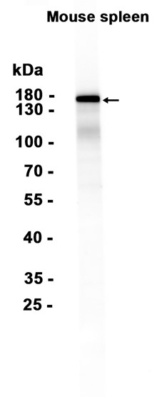 AYD12399