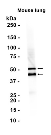 Cytokeratin 7 (YD31843) Rabbit mAb