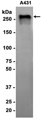 Acetyl Coenzyme A Carboxylase (YD13154) Rabbit mAb