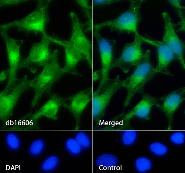 Axl (YD35942) Rabbit mAb