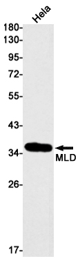 AYD12033