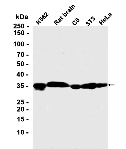 AYD11439