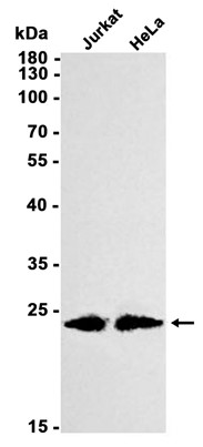 Phospho-Presenilin 1 (Ser310) (YD11353) Rabbit mAb