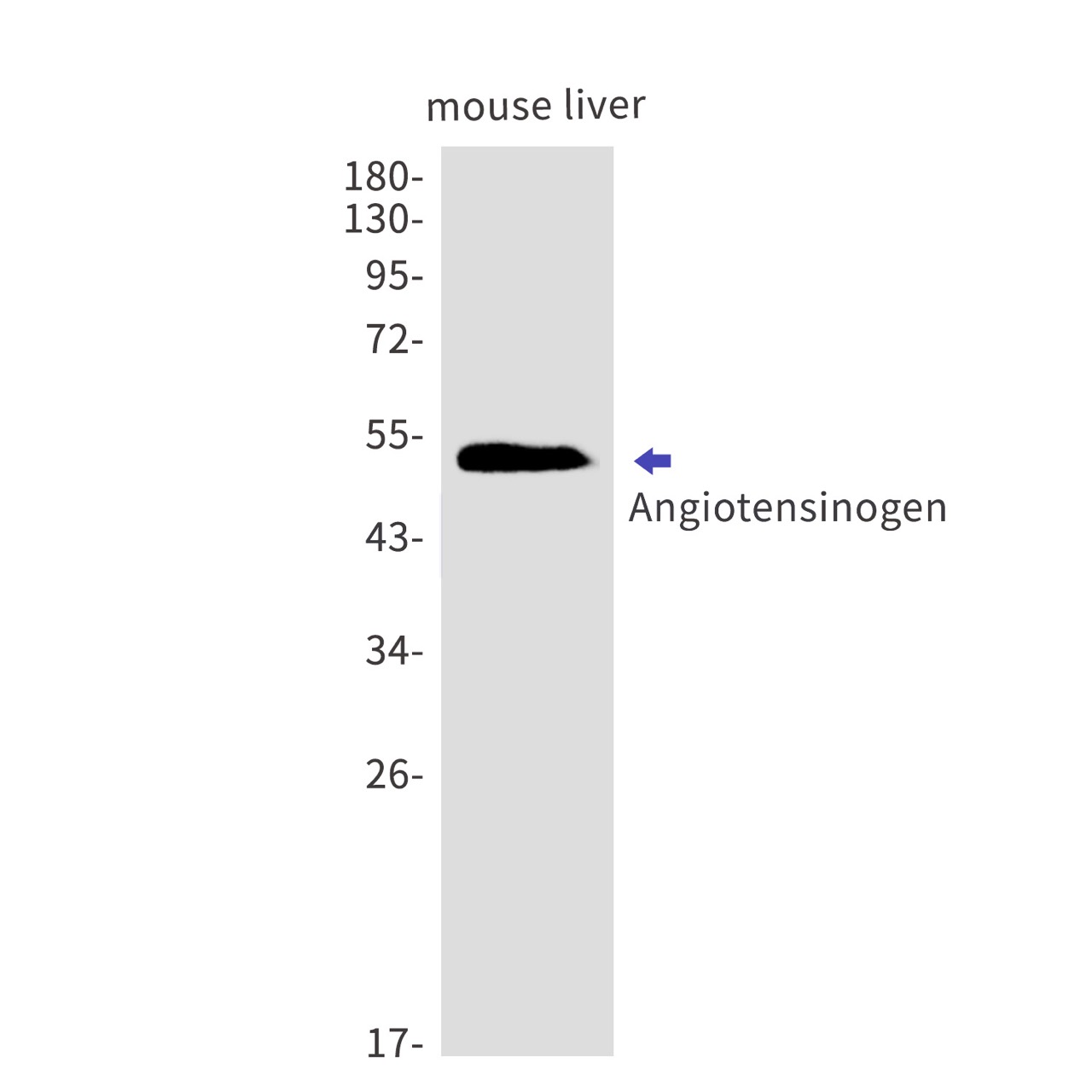 Angiotensinogen (YD16532) Rabbit mAb