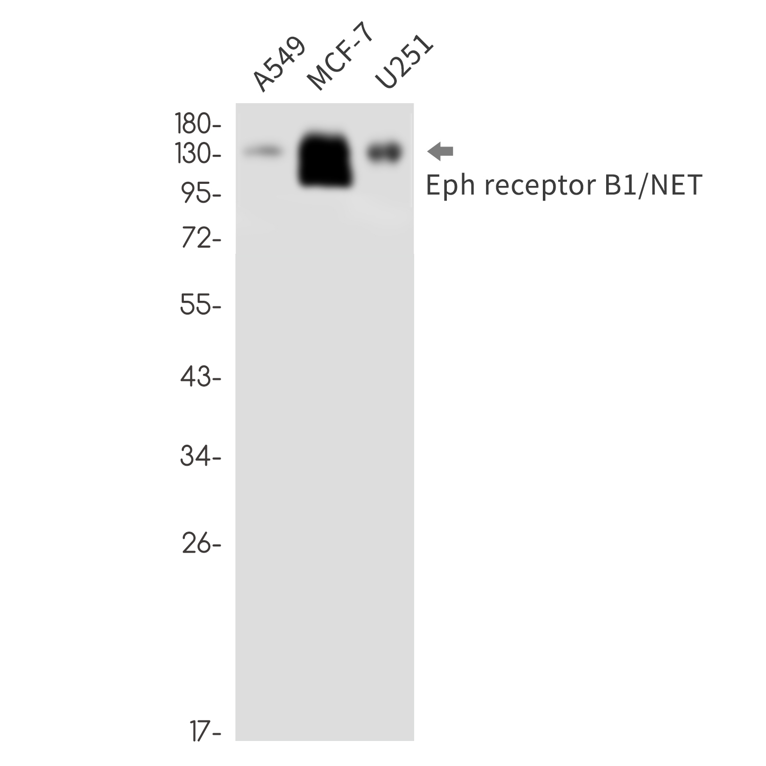 Ephrin Receptor B1 (YD31456) Rabbit mAb