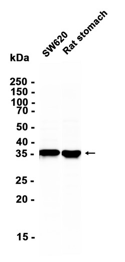 AYD11251