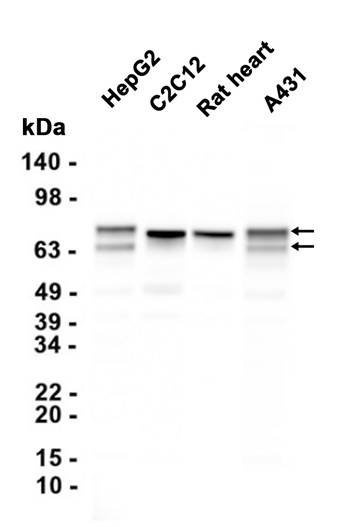 AYD11815