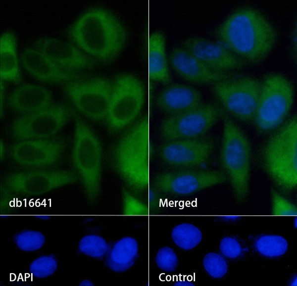 Glypican 3 (YD16457) Rabbit mAb