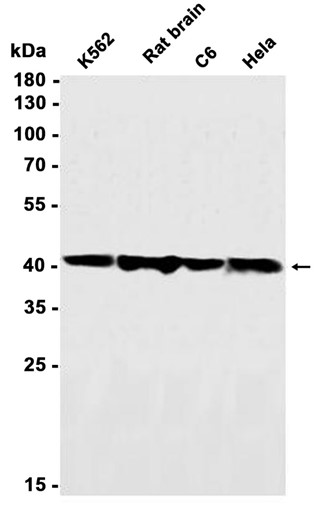 Creatine kinase B type (YD20638) Rabbit mAb