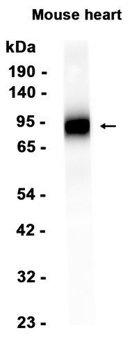CD39 (YD19160) Rabbit mAb