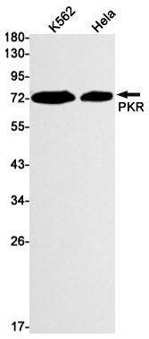 AYD11514