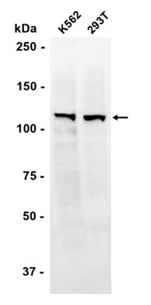 PI3-Kinase p110 beta (YD14149) Rabbit mAb