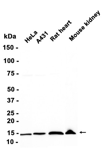 AYD11130