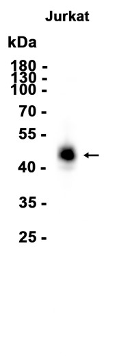 AYD14462