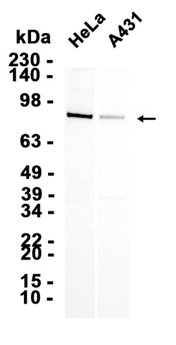 AYD15365