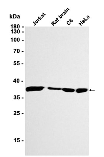 Lactate Dehydrogenase (YD13847) Rabbit mAb