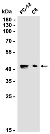 AYD12945