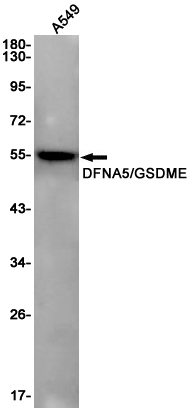 AYD14811