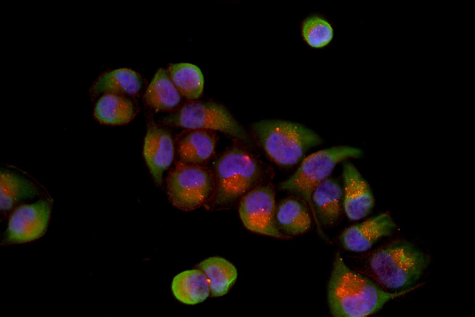Smad2/3 (Phospho Thr8) (YI0741) Rabbit mAb