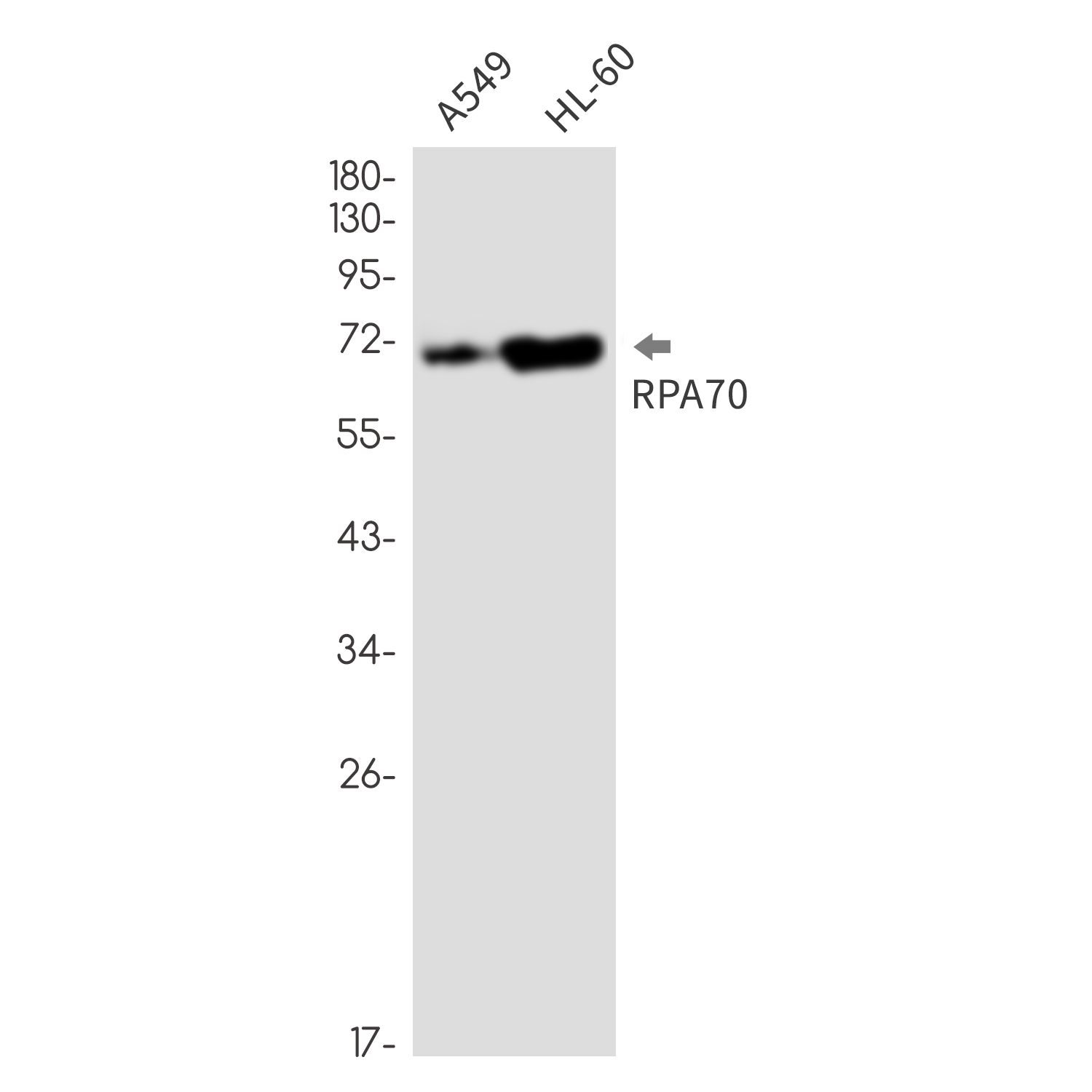 AYD11448