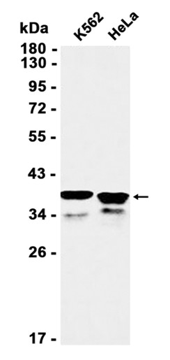 AYD11794