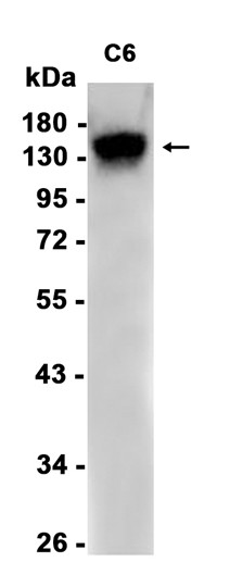 AYD11181