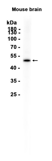 AYD15601