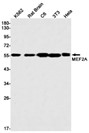 MEF2A (YD13524) Rabbit mAb