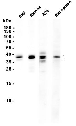CD20 (YD16322) Rabbit mAb