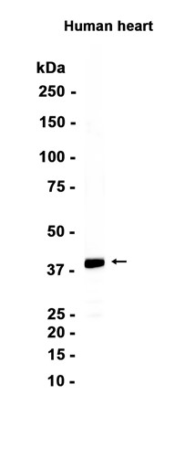 AYD13690