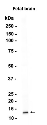 AYD14763