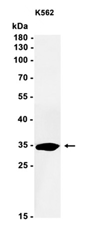 AYD11631