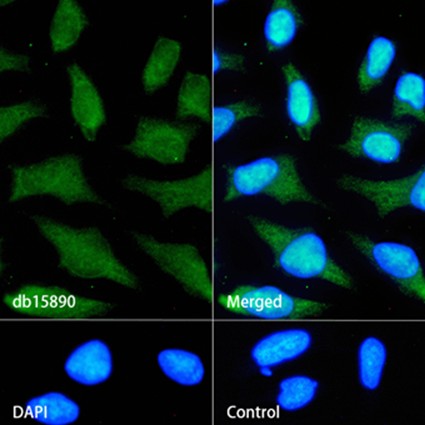 AKT1/2 (YD11878) Rabbit mAb