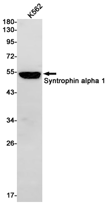 AYD14451
