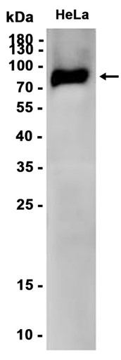 PKC (YD20433) Rabbit mAb