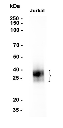 CD8 alpha (YD15321) Rabbit mAb