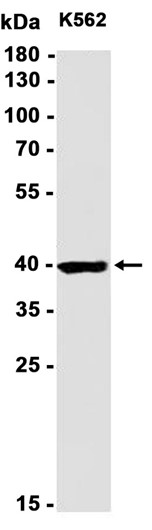 AYD11880