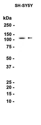 AYD14240