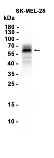 AYD15976