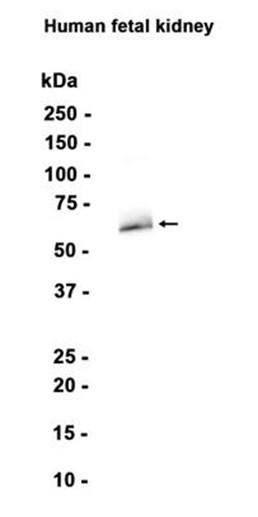 AYD13525