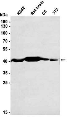 Creatine Kinase B type (YD18824) Rabbit mAb